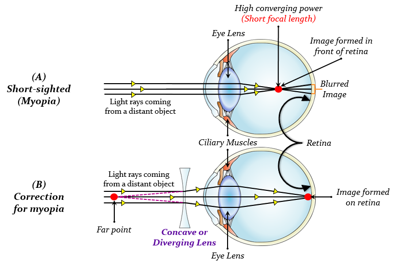 What is the high converging power of eye lens Tutorix